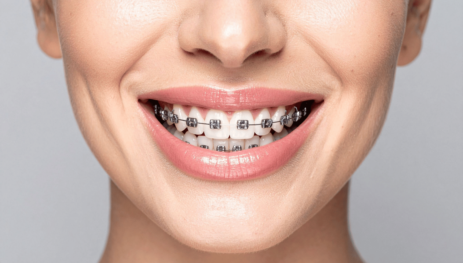Orthodontic Treatment: Understanding Your Options for a Healthier, Straighter Smile