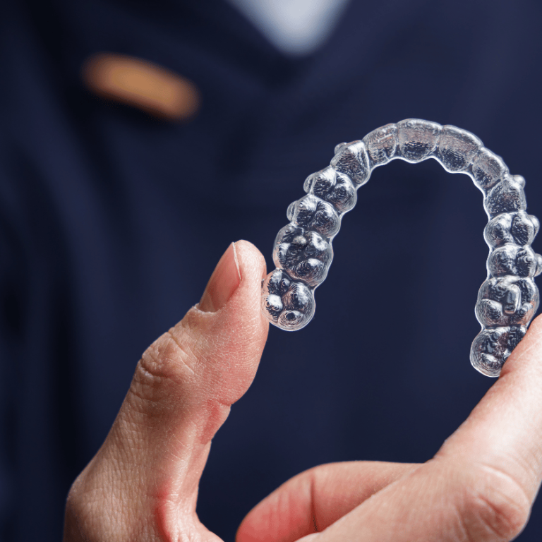 Understanding Invisalign: Cost, Benefits, Treatment Timeline, and What to Expect
